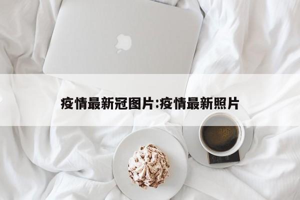 疫情最新冠图片:疫情最新照片